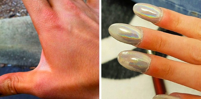 Девушки, которые на своём примере доказали, что красота действительно требует жертв