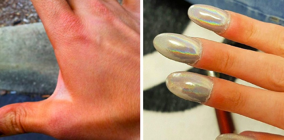 Девушки, которые на своём примере доказали, что красота действительно требует жертв