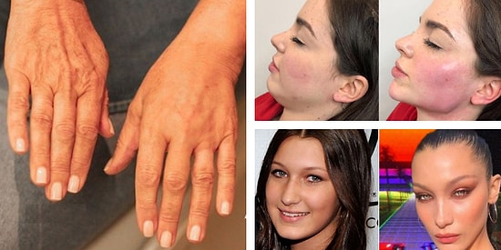 'Yeni Yılda Yeni Bir Ben Lazım' Diyenlere: 2019 Estetik Operasyon Trendleri Belli Oldu!