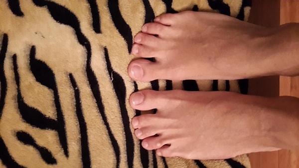 2. У кого были сросшиеся пальцы на левой ноге?