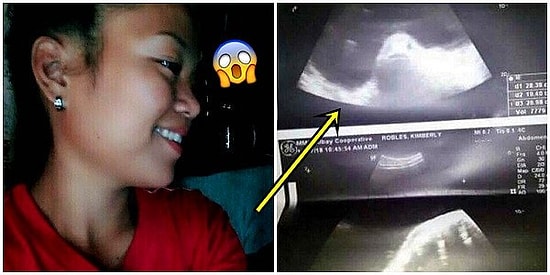 Удивительное рядом: 17-летнюю филиппинку подозревают в беременности от хищной рыбы