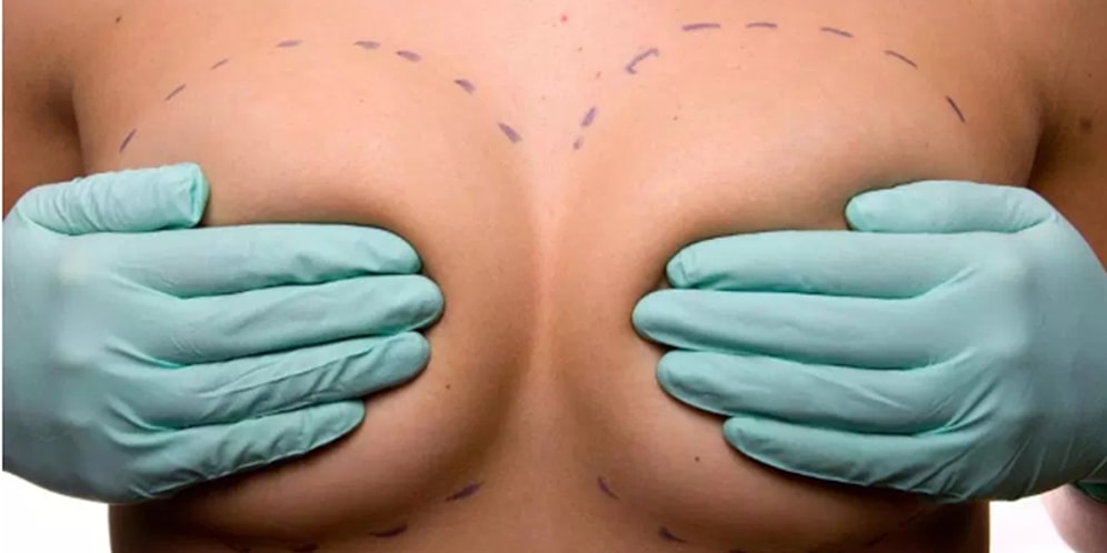 Uzmanlara Göre Meme İmplantı Kanser, Düşük ve Eklem Yangısı İhtimalini Arttırıyor!