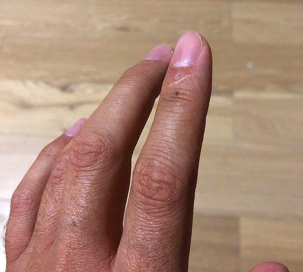 1. İşaret parmağınızda yara izi var mı?