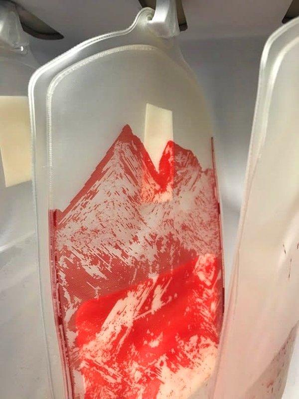 11. Boşaltılmış kan torbasının oluşturduğu dağ manzarası.