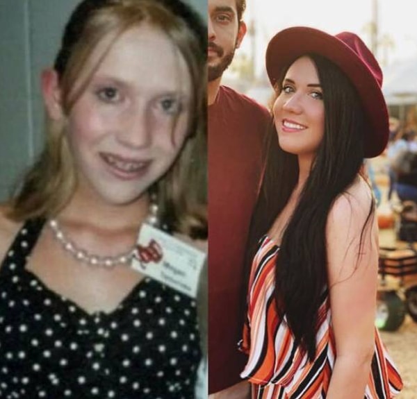 9. Ну ведь не зря же брекеты носила!