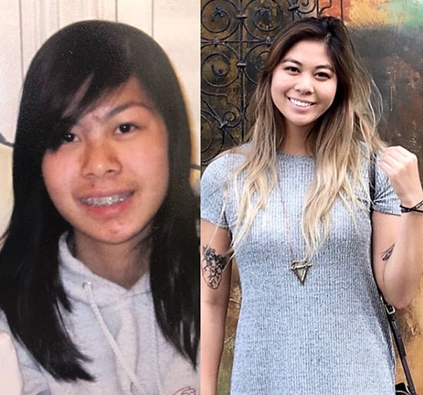 12. Да, отсутствие брекетов здорово меняет дело.