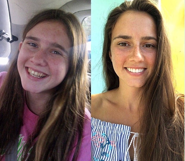 13. Загар и белые зубы украсят любого!