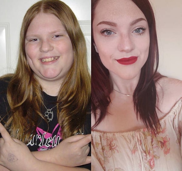 18. Эта девушка, должно быть, скинула не менее 10 кг.