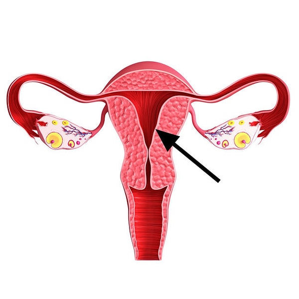 8. Давайте взглянем спереди. Как называется эта часть матки?