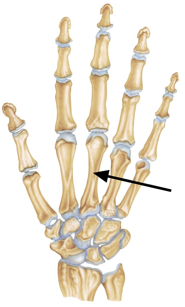 14. Как называется эта кость кисти?