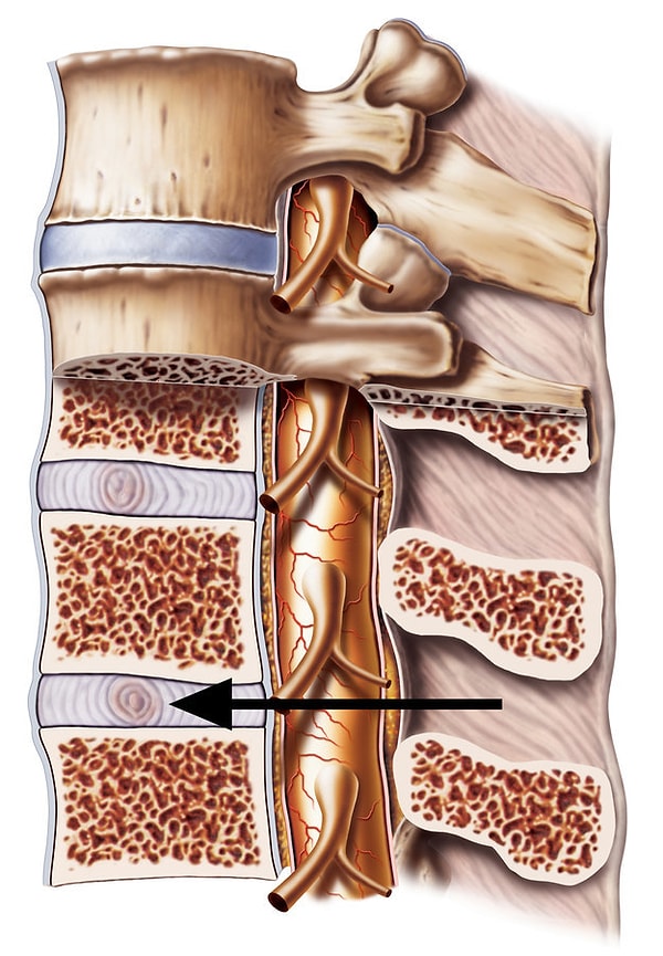 15. На очереди позвоночник. Как называется эта его часть?