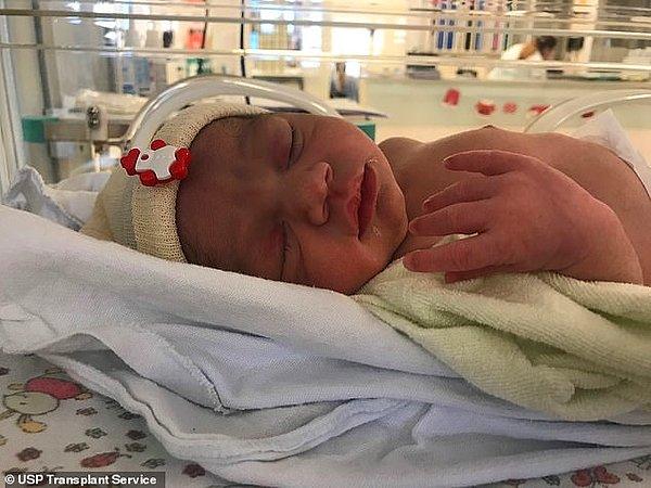Henüz ismi belli olmayan bebek, geçen yıl aralık ayında Sao Pauo, Brezilya'da dünyaya geldi.