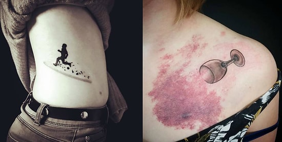 16 классных примеров того, как с помощью татуировки можно спрятать любой дефект