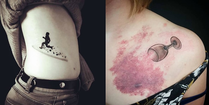 16 классных примеров того, как с помощью татуировки можно спрятать любой дефект