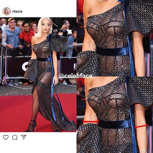 13. Rita Ora'nın farklı kalınlıklardaki kolları şüphe uyandırdı.