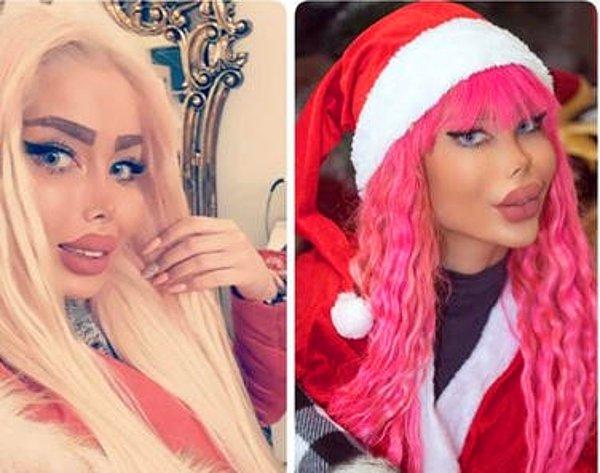 Tabar'ın en yakın arkadaşlarından biri de Barbie'ye benzemeye çalışan Instagram'ın bir diğer fenomeni 'Sanaztt' isimli bir kullanıcı.