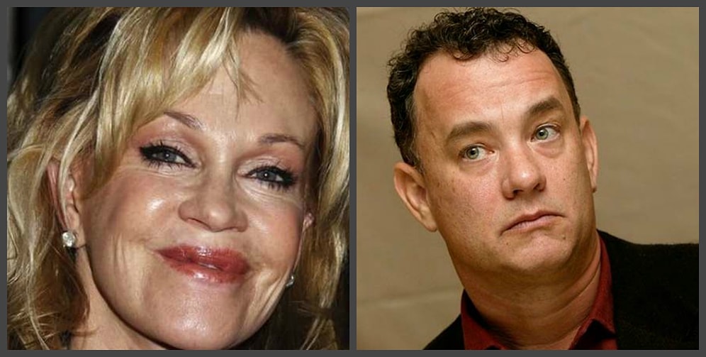 Когда хроническое заболевание не мешает быть звездой: истории знаменитостей с необычными болезнями