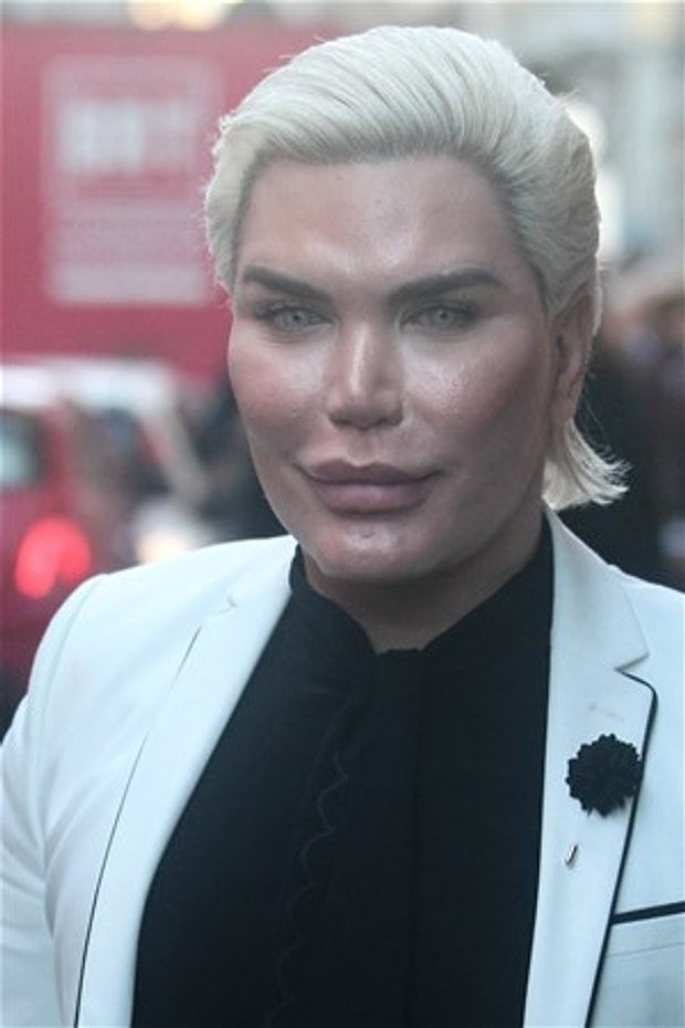 Ken Bebek Olarak Taninan Rodrigo Alves In Son Hali Gorenleri Saskina Cevirdi