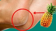 Kabuğu Bile Değerli Olan Ananasın Hem Sağlık Hem Güzellik Dolu Faydaları