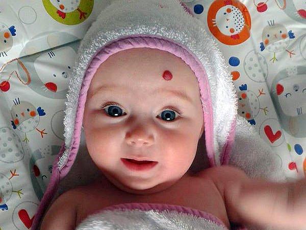 12. Bebeğimin yüzündeki ya da vücudundaki doğum lekeleri ne zaman geçer?