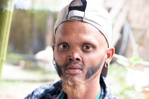 Ягья утверждает, что он обладает самым длинным языком в мире и является единственным человеком на планете, способным лизнуть собственный лоб.