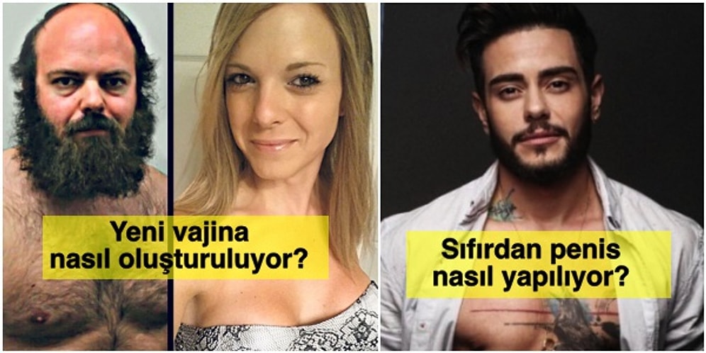 Cinsiyet Geçiş Operasyonlarıyla İlgili İnsanların En Çok Merak Ettiği Soruların Cevaplarını Veriyoruz!
