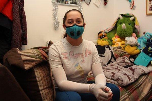 23 yaşındaki Bethany Herauville'in havadaki toza bile alerjisi var. Dolayısıyla yaşamak onun için gerçekten zor.