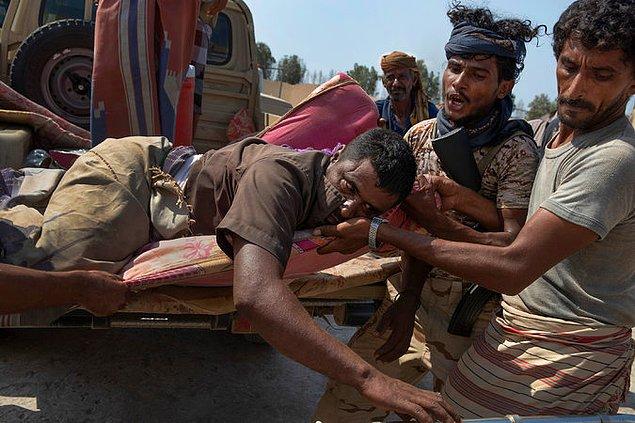 Bir hastane bağışı sırasında yaralanan Yemenli asker.
