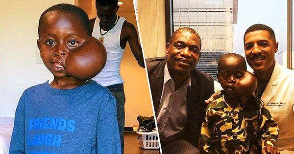 Demokratik Kongo Cumhuriyeti'nden 8 yaşındaki Matadi Sela Petit, Los Angelas'taki Cedars-Sinai Medical Center'da hayata gözlerini kapadı.