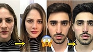 Doktor Bu Ne? Öncesi ve Sonrası Fotoğraflarıyla Sizde Soğuk Duş Almış Etkisi Yaratacak 20 Estetik Mucizesi