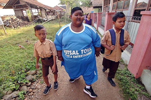 В апреле 2018 года мальчику была сделана операция на желудок, благодаря которой он наконец начал терять лишний вес.