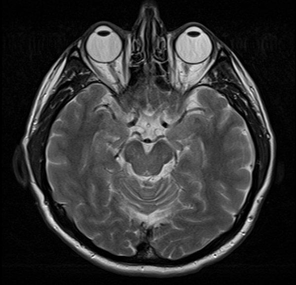 4. Sağlıklı bir insan beyninin MRI'ı:
