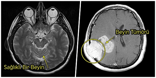 Tüm Bu Et ve Derinin Altında Ne Var? İnsan Vücudundan 15 Şaşırtıcı Tarama Görüntüsü
