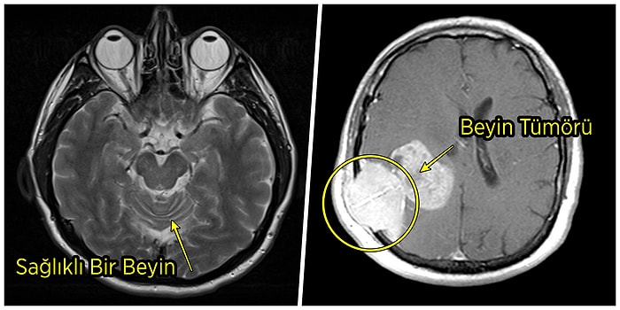 Tüm Bu Et ve Derinin Altında Ne Var? İnsan Vücudundan 15 Şaşırtıcı Tarama Görüntüsü