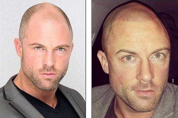 1. Татуировки для лысых