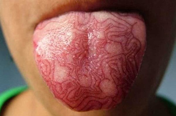 4. Татуировка на языке