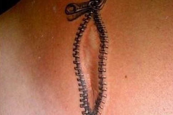 5. Молнии для маскировки шрамов