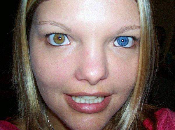 7. Heterokromya insanların farklı renkli gözlere sahip olmasına neden oluyor.