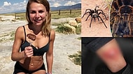 Eskiden Vegandı Şimdi Sadece Et Yiyor! Örümcek Tarafından Isırıldıktan Sonra Et Yemeye Başlayan Kadın