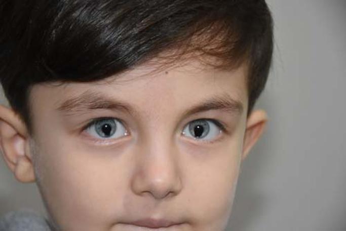 Gece Karanliginda Dahi Gorebilen Kedi Gozlu Cocuk