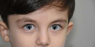 Gece Karanlığında Dahi Görebilen Kedi Gözlü Çocuk!