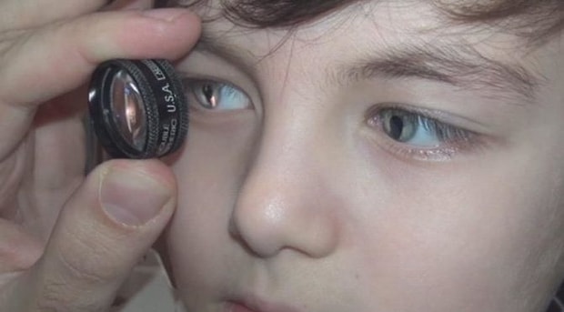 Gece Karanliginda Dahi Gorebilen Kedi Gozlu Cocuk