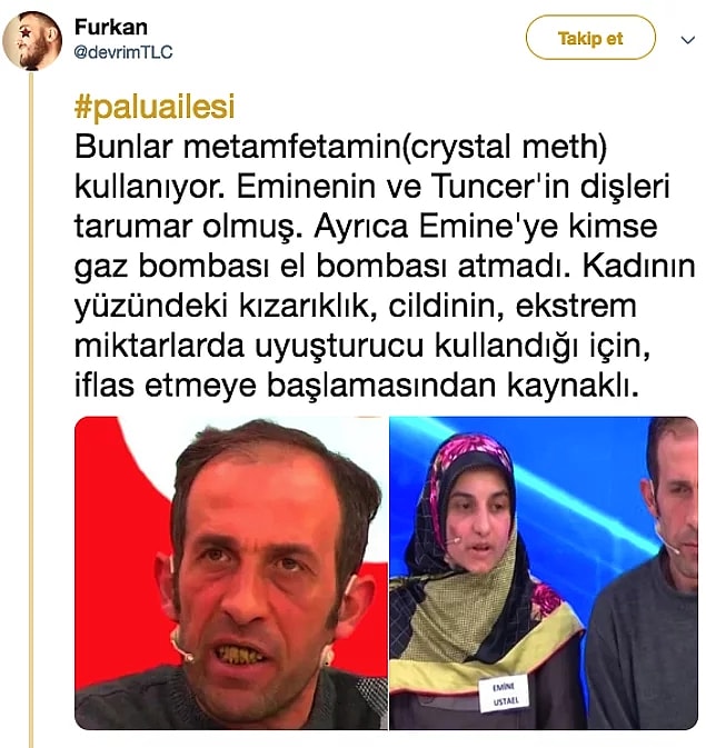 Uyuşturucu kullanımı yaygın olsa da, insanların dişlerinin sebebi bu değil.