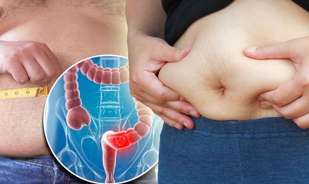 1. Mide kanseri nedir?