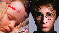 Bu Gerçek Harry Potter Hayranlarını Şaşırtacak! Harry'nin Alnındaki İzin Aslında Ne Olduğunu Biliyor musunuz?
