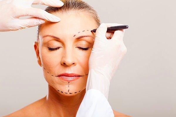 Bir diğer yöntem ise "endeskop" ile yapılan ameliyattır. Genellikle daha az sarkması bulunan insanlar için önerilir. Bu teknikte saçlı deride küçük bir kesit açılır ve yüz yukarıya doğru gerilir.