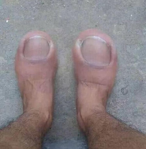 3. Страдающие подофобией (боязнь ног), вы уже закрыли наш сайт или еще держитесь? )))