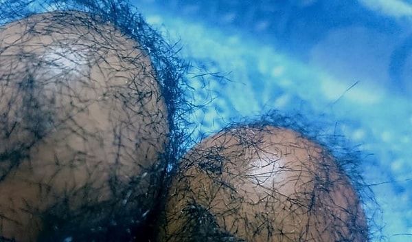 7. Волосатые яйца...