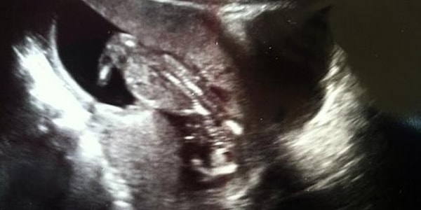 9. Похоже, эта пара ждет появления на свет маленького милого... дятла?