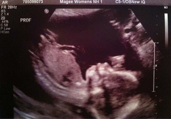 11. Если посмотреть в правый угол снимка, можно увидеть самую впечатляющую фотобомбу с котиком.